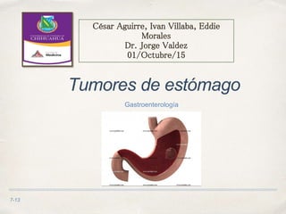 7-13
Tumores de estómago
Gastroenterología
César Aguirre, Ivan Villaba, Eddie
Morales
Dr. Jorge Valdez
01/Octubre/15
 