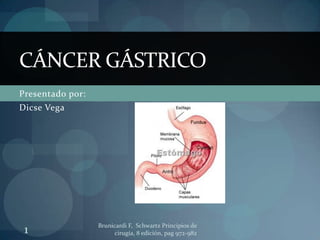 CÁNCER GÁSTRICO
Presentado por:
Dicse Vega




                  Brunicardi F, Schwartz Principios de
 1                      cirugía, 8 edición, pag 972-982
 