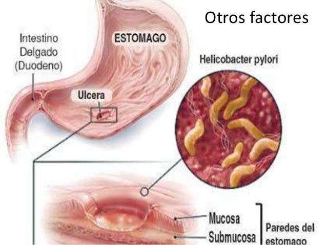 Estoy que pastillas puedo tomar para bajar rapido de peso seguro que Que pastillas puedo tomar para bajar rapido de peso por contrario estos