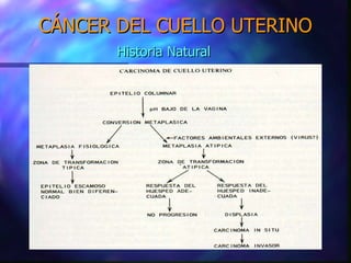 CÁNCER DEL CUELLO UTERINO Historia Natural 