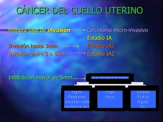 CÁNCER DEL CUELLO UTERINO Primera fase de  invasión     carcinoma micro-invasivo   Estadío IA Invasión hasta 3mm.     Estadío IA1 Invasión entre 3 a 5mm.   Estadío IA2 Infiltración mayor de 5mm. 