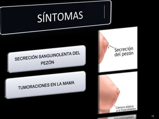 SÍNTOMAS 13