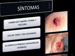 SÍNTOMAS 14