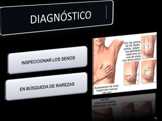DIAGNÓSTICO 15