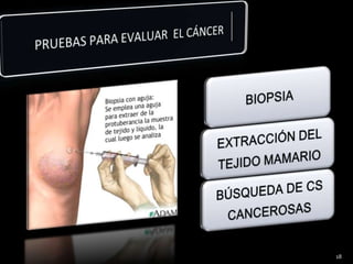 PRUEBAS PARA EVALUAR EL CÁNCER18
