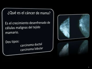 ¿Qué es el cáncer de mama?Es el crecimiento desenfrenado de células malignas del tejido mamario.Dos tipos: carcinoma ductal carcinoma lobular 2