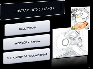 TRATRAMIENTO DEL CÁNCER20