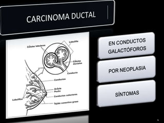 CARCINOMA DUCTAL 4