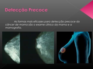 As formas mais eficazes para detecção precoce do
câncer de mama são o exame clínico da mama e a
mamografia.
 