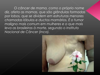 O câncer de mama, como o próprio nome
diz, afeta as mamas, que são glândulas formadas
por lobos, que se dividem em estruturas menores
chamadas lóbulos e ductos mamários. É o tumor
maligno mais comum em mulheres e o que mais
leva as brasileiras à morte, segundo o Instituto
Nacional de Câncer (Inca).
 