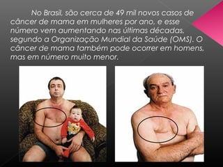 No Brasil, são cerca de 49 mil novos casos de
câncer de mama em mulheres por ano, e esse
número vem aumentando nas últimas décadas,
segundo a Organização Mundial da Saúde (OMS). O
câncer de mama também pode ocorrer em homens,
mas em número muito menor.
 