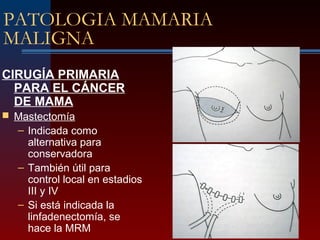 PATOLOGIA MAMARIA
MALIGNA
CIRUGÍA PRIMARIA
PARA EL CÁNCER
DE MAMA
 Mastectomía
– Indicada como
alternativa para
conservadora
– También útil para
control local en estadios
III y IV
– Si está indicada la
linfadenectomía, se
hace la MRM
 