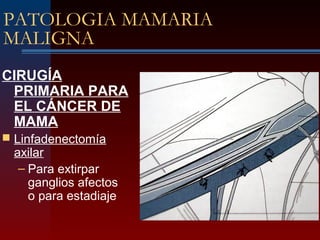 PATOLOGIA MAMARIA
MALIGNA
CIRUGÍA
PRIMARIA PARA
EL CÁNCER DE
MAMA
 Linfadenectomía
axilar
– Para extirpar
ganglios afectos
o para estadiaje
 