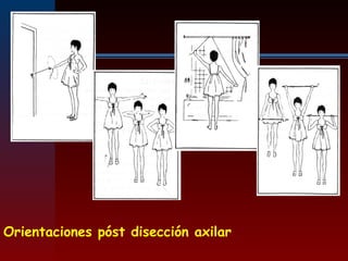 Orientaciones póst disección axilar
 