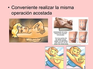• Conveniente realizar la misma
operación acostada
 