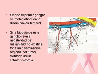 • Siendo el primer ganglio
en metastatizar en la
diseminación tumoral
• Si la biopsia de este
ganglio revela
negatividad de
malignidad no existiría
todavía diseminación
regional del tumor
evitando así la
linfadenectomía.
 