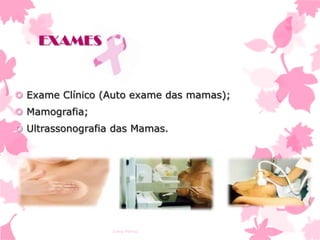 EXAMES

 Exame Clínico (Auto exame das mamas);
 Mamografia;
 Ultrassonografia das Mamas.

Ivana Ferraz

 