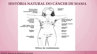 HISTÓRIA NATURAL DO CÂNCER DE MAMA 
FONTE: Manual do Ministério da Saúde 
10  