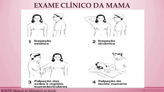 EXAME CLÍNICO DA MAMA 
FONTE: Manual do Ministério da Saúde 
19  
