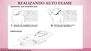 REALIZANDO AUTO EXAME 
FONTE: Manual do Ministério da Saúde 
20  