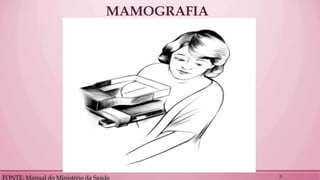 MAMOGRAFIA 
FONTE: Manual do Ministério da Saúde 
21  