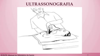 ULTRASSONOGRAFIA 
FONTE: Manual do Ministério da Saúde 
22  
