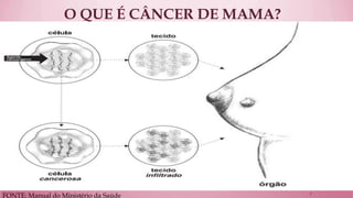 O QUE É CÂNCER DE MAMA? 
FONTE: Manual do Ministério da Saúde 
7  