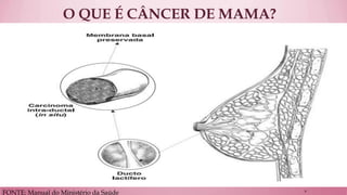 O QUE É CÂNCER DE MAMA? 
FONTE: Manual do Ministério da Saúde 
8  
