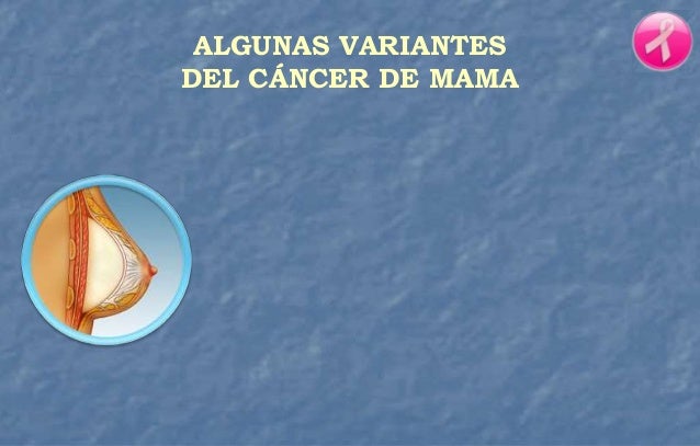 Tiene Cura El Cáncer De Esternón