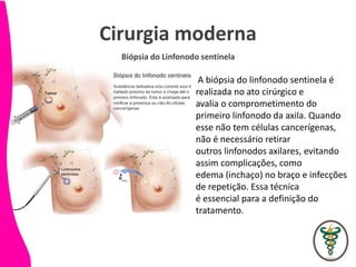 Cirurgia moderna
Biópsia do Linfonodo sentinela
A biópsia do linfonodo sentinela é
realizada no ato cirúrgico e
avalia o comprometimento do
primeiro linfonodo da axila. Quando
esse não tem células cancerígenas,
não é necessário retirar
outros linfonodos axilares, evitando
assim complicações, como
edema (inchaço) no braço e infecções
de repetição. Essa técnica
é essencial para a definição do
tratamento.
 