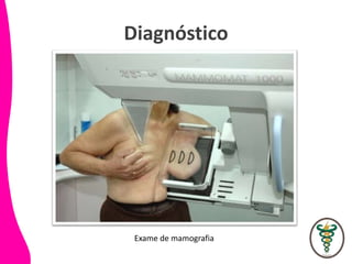 Diagnóstico
Exame de mamografia
 