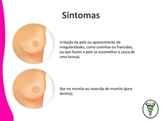 Sintomas
Irritação da pele ou aparecimento de
irregularidades, como covinhas ou franzidos,
ou que fazem a pele se assemelhar à casca de
uma laranja;
Dor no mamilo ou inversão do mamilo (para
dentro);
 