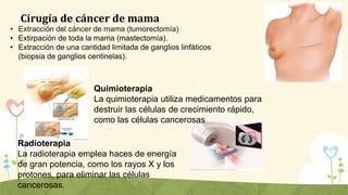 Cirugía de cáncer de mama
• Extracción del cáncer de mama (tumorectomía)
• Extirpación de toda la mama (mastectomía).
• Ex...
