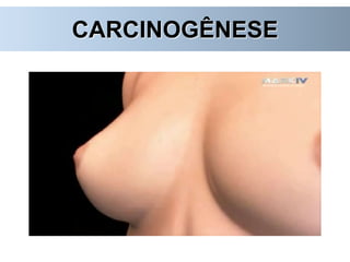 CARCINOGÊNESE
 