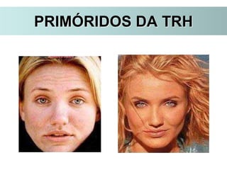 PRIMÓRIDOS DA TRH
 