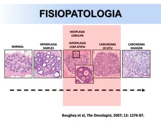 Boughey et al, The Oncologist, 2007; 12: 1276-87.
NORMAL
HIPERPLASIA
SIMPLES
NEOPLASIA
LOBULAR
HIPERPLASIA
COM ATIPIA
CARCINOMA
IN SITU
CARCINOMA
INVASOR
FISIOPATOLOGIA
 