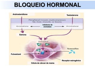 BLOQUEIO HORMONAL
Fulvestrant
Testosterona
Estrona
Androstenidiona
Receptor estrogênico
Célula de câncer de mama
Inibidores de
aromatase
 
