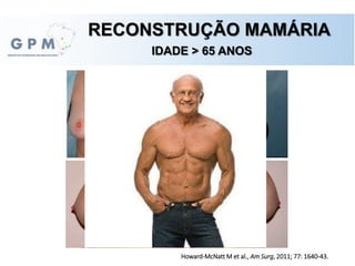 RECONSTRUÇÃO MAMÁRIA
IDADE > 65 ANOS
Howard-McNatt M et al., Am Surg, 2011; 77: 1640-43.
 