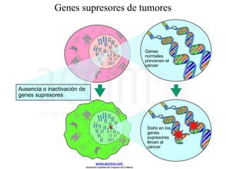 Genes supresores de tumores
Mutated/inactivated
tumor suppressor genes
Genes
normales
previenen el
cáncer
Ausencia o inactivación de
genes supresores
Daño en los
genes
supresores
llevan al
cáncer
Cancer cell
Normal cell
www.aecima.com
Asociación Española de Cirujanos de la Mama
 