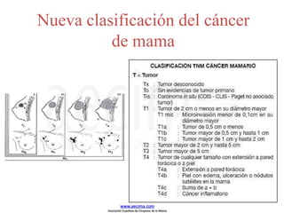 Nueva clasificación del cáncer
de mama
www.aecima.com
Asociación Española de Cirujanos de la Mama
 