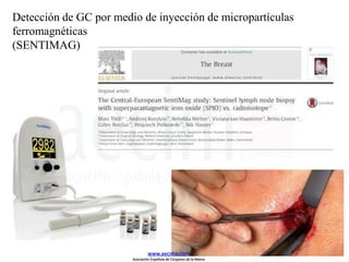 Detección de GC por medio de inyección de micropartículas
ferromagnéticas
(SENTIMAG)
www.aecima.com
Asociación Española de Cirujanos de la Mama
 