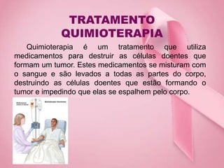 TRATAMENTO
QUIMIOTERAPIA
Quimioterapia é um tratamento que utiliza
medicamentos para destruir as células doentes que
formam um tumor. Estes medicamentos se misturam com
o sangue e são levados a todas as partes do corpo,
destruindo as células doentes que estão formando o
tumor e impedindo que elas se espalhem pelo corpo.
 