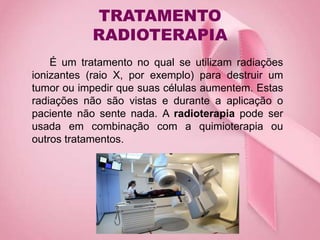 TRATAMENTO
RADIOTERAPIA
É um tratamento no qual se utilizam radiações
ionizantes (raio X, por exemplo) para destruir um
tumor ou impedir que suas células aumentem. Estas
radiações não são vistas e durante a aplicação o
paciente não sente nada. A radioterapia pode ser
usada em combinação com a quimioterapia ou
outros tratamentos.
 