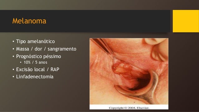 anal com dor doce tentação anal com dor doce tentação