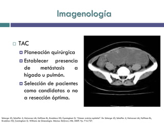 Imagenología
 TAC
 Planeación quirúrgica
 Establecer presencia
de metástasis a
hígado u pulmón.
 Selección de pacientes
como candidatas o no
a resección óptima.
Schorge JO, Schaffer JI, Halvorson LM, Hoffman BL, Bradshaw KD, Cunningham G. “Cáncer ovárico epitelial”. En: Schorge JO, Schaffer JI, Halvorson LM, Hoffman BL,
Bradshaw KD, Cunningham G. Williams de Ginecología. México: McGraw.-Hill; 2009. Pp. 716-737.
 