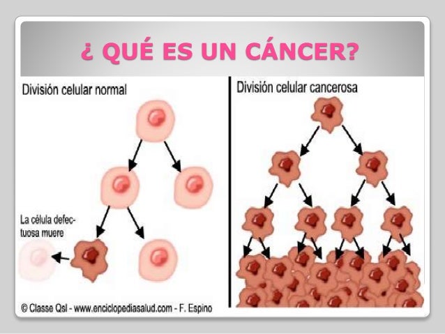 Cáncer de ovario epitelial