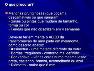 O que procurar?O que procurar?
Manchas pruriginosas (que coçam),Manchas pruriginosas (que coçam),
descamativas ou que sangramdescamativas ou que sangram
• Sinais ou pintas que mudam de tamanho,• Sinais ou pintas que mudam de tamanho,
forma ou corforma ou cor
• Feridas que não cicatrizam em 4 semanas• Feridas que não cicatrizam em 4 semanas
Deve-se ter em mente o ABCD daDeve-se ter em mente o ABCD da
transformação de uma pinta em melanoma,transformação de uma pinta em melanoma,
como descrito abaixo:como descrito abaixo:
•• AAssimetria - uma metade diferente da outrassimetria - uma metade diferente da outra
•• BBordas irregulares - contorno mal definidoordas irregulares - contorno mal definido
•• CCor variável - várias cores numa mesma lesão:or variável - várias cores numa mesma lesão:
preta, castanho, branca, avermelhada ou azulpreta, castanho, branca, avermelhada ou azul
•• DDiâmetro - maior que 6 mmiâmetro - maior que 6 mm
 