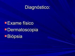 Diagnóstico:Diagnóstico:
Exame físicoExame físico
DermatoscopiaDermatoscopia
BiópsiaBiópsia
 