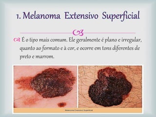  É o tipo mais comum. Ele geralmente é plano e irregular,
quanto ao formato e à cor, e ocorre em tons diferentes de
preto e marrom.
 