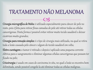 Cirurgia micrográficade Mohs: é utilizado especialmente para câncer de pele no
rosto, pois é feita para retirar finas camadas de pele até retirar todas as células
cancerígenas. Desta forma é possível evitar retirar muito tecido saudável e deixar
cicatrizes muito grandes;
Cirurgia pararemoção simples: é o tipo de cirurgia mais utilizada, na qual se retira
toda a lesão causada pelo câncer e algum do tecido saudável em volta;
Eletro-curetagem: o tumor é retirado e depois é aplicado uma pequena corrente
elétrica para o sangramento e eliminar algumas células cancerígenas que possam ter
ficado na pele;
Criocirurgia: é usado em casos de carcinoma in situ, no qual a lesão se encontra bem
delimitada, sendo possível congelá-la até eliminar todas as células malignas.
 